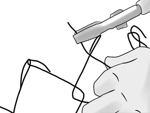 Untwist the top and bottom of loops on one strand of fence wire by using pliers.